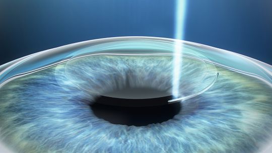 Augentechnologie