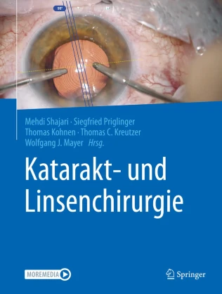 Buch Katarakt Chirurgie